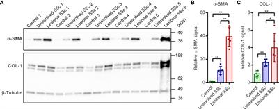 Exploring metabolism in scleroderma reveals opportunities for pharmacological intervention for therapy in fibrosis